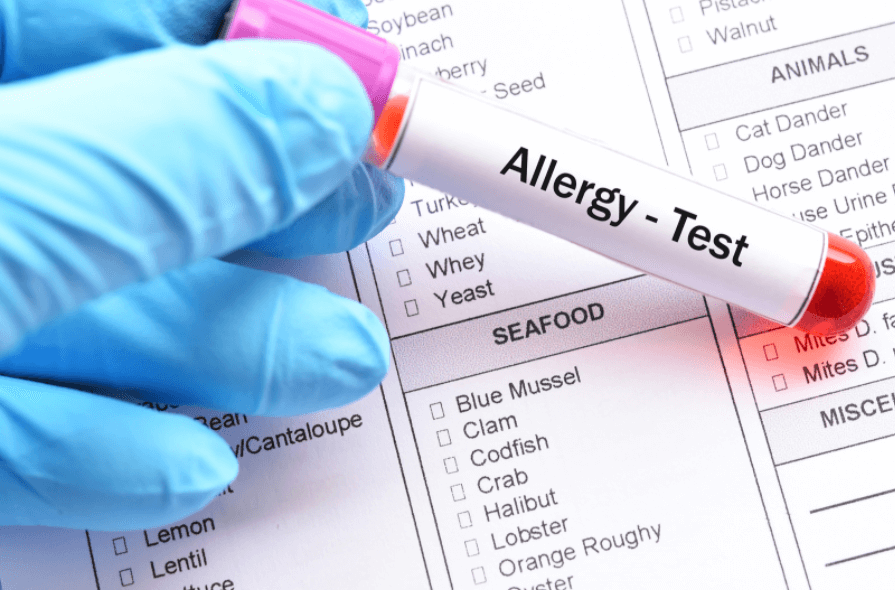 Food Allergy test